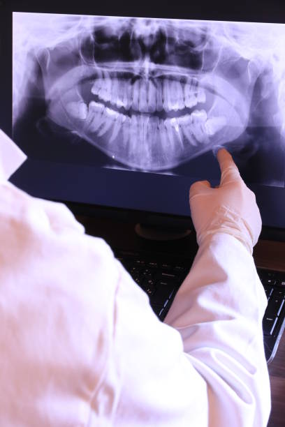 Best Emergency Root Canal Treatment in Attica, MI