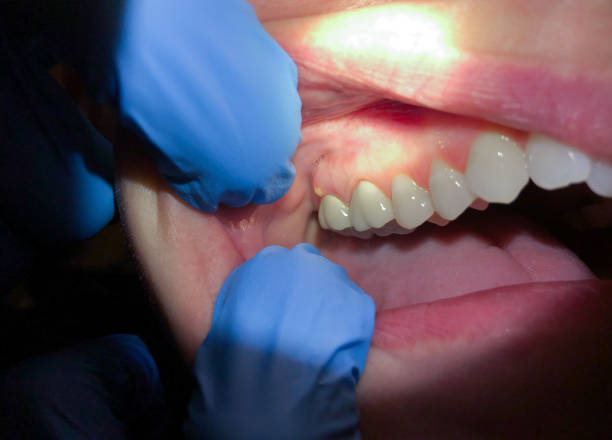 Best Emergency Cosmetic Dentistry in Attica, MI