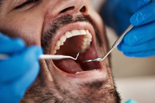 Best Pediatric Emergency Dentist in Attica, MI