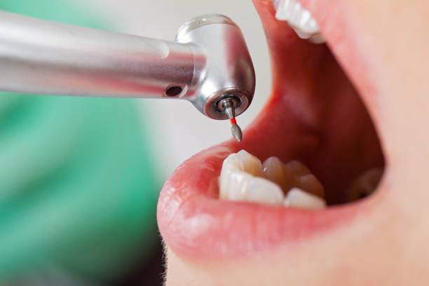 Best Emergency Dentist for Knocked-Out Tooth in Attica, MI